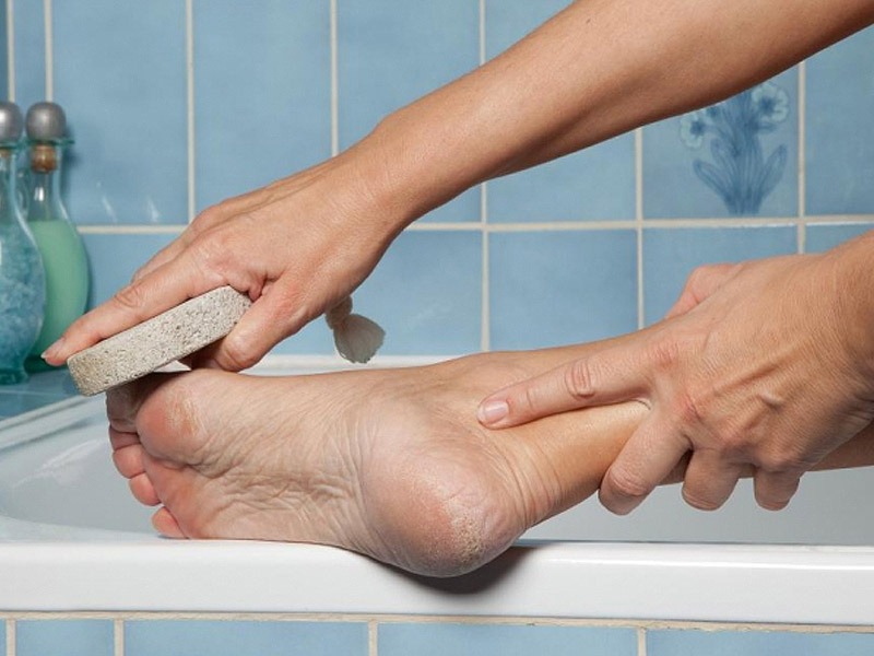 Без ванн, терок і дорогих засобів: як зробити п'яти гладкими за кілька хвилин